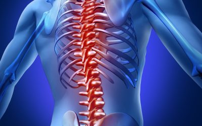 Relieve Pain Faster by Understanding Pinched Nerve in Little Rock AR Treatment Options
